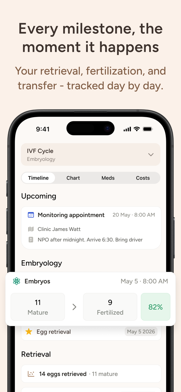Reti's IVF cycle timeline tracking retrieval, fertilization, and transfer